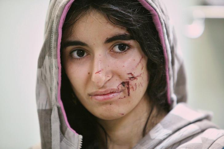 Una donna sfollata ferita negli scontri durante la fuga dallo Stato Islamico di Mosul viene medicata in un ospedale a ovest di Erbil, Iraq, 25 novembre 2016. REUTERS / Azad Lashkari