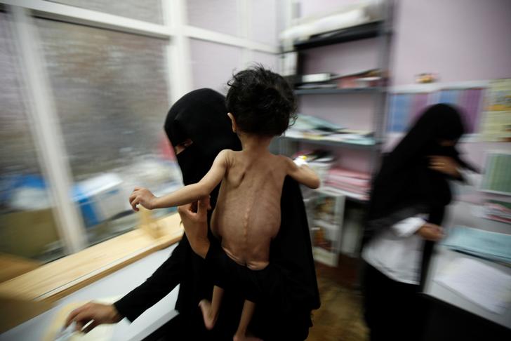 Una donna tiene in braccio il suo bambino che è stato pesato in una unità ospedaliera di terapia intensiva per la malnutrizione a Sanaa, nello Yemen il 27 settembre 2016. REUTERS / Khaled Abdullah